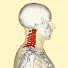 Cervical Spondylitis